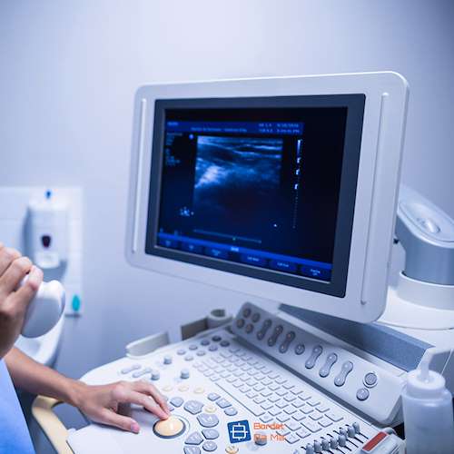 بازیابی انواع برد تجهیزات مراکز سونوگرافی - بردت با ما